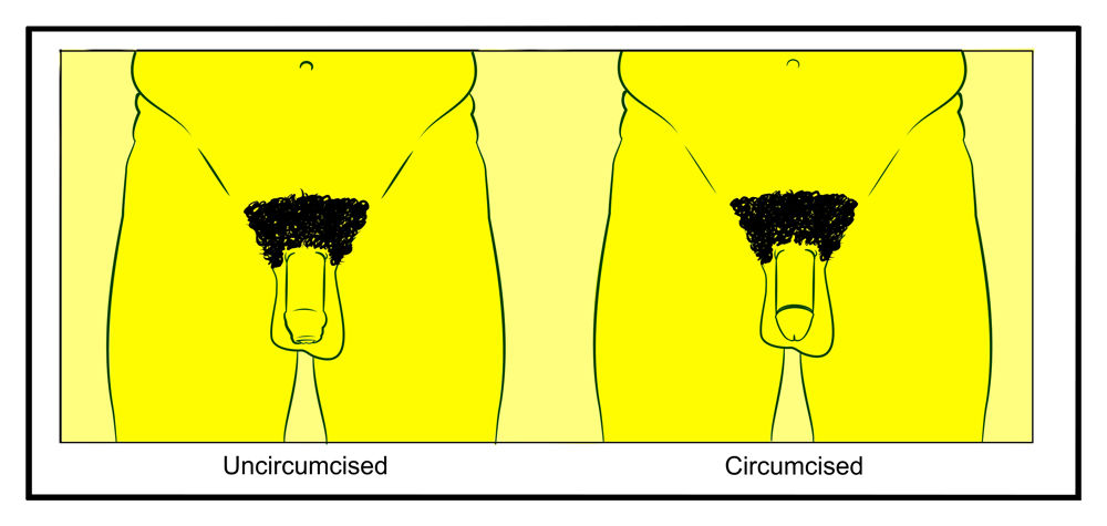 Front view cartoon images of an uncircumsised penis and a circumcised penis
