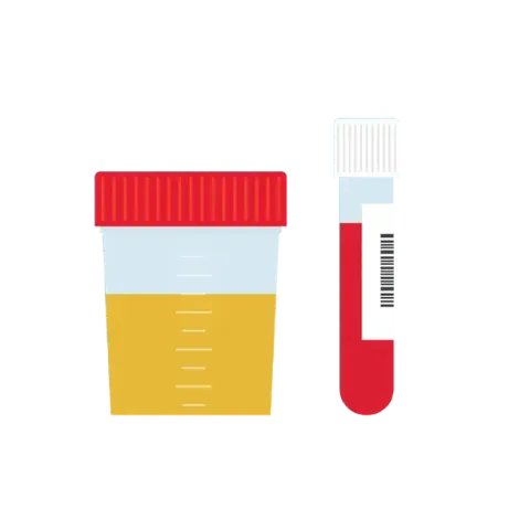 urine and blood sample